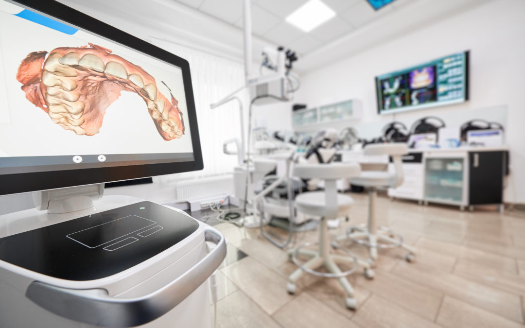 itero scanner showing teeth in a dental office