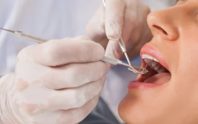 The Science Behind Dental Plaque: What It Is and How to Fight It