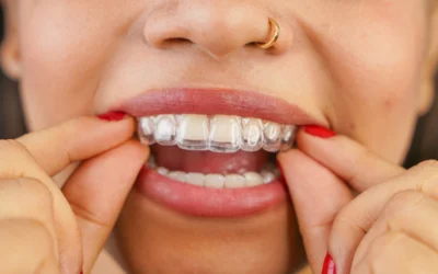Orthodontics for Adults: It’s Never Too Late to Straighten Your Smile