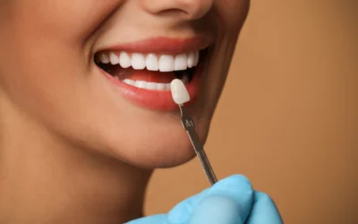 Beyond Whitening: Bonding and Veneers